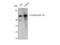 Keratin 10 antibody, STJ92624, St John