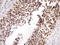 Zinc Finger CCCH-Type Containing 8 antibody, LS-C340464, Lifespan Biosciences, Immunohistochemistry paraffin image 