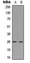 Troponin I3, Cardiac Type antibody, orb304638, Biorbyt, Western Blot image 
