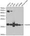 N(Alpha)-Acetyltransferase 50, NatE Catalytic Subunit antibody, 22-907, ProSci, Western Blot image 