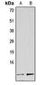 NUOMS antibody, LS-C353489, Lifespan Biosciences, Western Blot image 