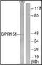 G Protein-Coupled Receptor 151 antibody, orb95457, Biorbyt, Western Blot image 