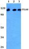 Integrin Subunit Alpha 8 antibody, A06636, Boster Biological Technology, Western Blot image 