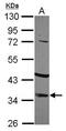 Insulin-like growth factor-binding protein 2 antibody, GTX113471, GeneTex, Western Blot image 