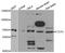 CCCTC-Binding Factor Like antibody, PA5-76856, Invitrogen Antibodies, Western Blot image 