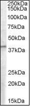 Eukaryotic Translation Initiation Factor 3 Subunit M antibody, orb88111, Biorbyt, Western Blot image 