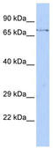 F-box/WD repeat-containing protein 8 antibody, TA330939, Origene, Western Blot image 