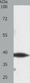 Deltex E3 Ubiquitin Ligase 3 antibody, TA322000, Origene, Western Blot image 