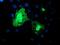 Dystrobrevin Beta antibody, MA5-25856, Invitrogen Antibodies, Immunocytochemistry image 