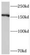 Stromal Antigen 1 antibody, FNab08281, FineTest, Western Blot image 