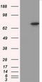 Protein Kinase CGMP-Dependent 1 antibody, M01708-1, Boster Biological Technology, Western Blot image 