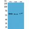 Cytochrome P450 Family 11 Subfamily B Member 1 antibody, LS-C386978, Lifespan Biosciences, Western Blot image 