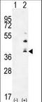 TNF Superfamily Member 15 antibody, LS-C160074, Lifespan Biosciences, Western Blot image 