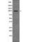 Androgen Receptor antibody, PA5-64643, Invitrogen Antibodies, Western Blot image 