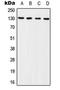 BCAR1 Scaffold Protein, Cas Family Member antibody, GTX32286, GeneTex, Western Blot image 