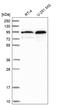 Transmembrane And Coiled-Coil Domains 3 antibody, HPA039561, Atlas Antibodies, Western Blot image 