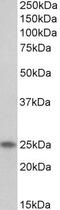 Troponin I1, Slow Skeletal Type antibody, PA5-37897, Invitrogen Antibodies, Western Blot image 