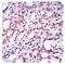 Zinc Finger E-Box Binding Homeobox 1 antibody, NBP2-23484, Novus Biologicals, Immunohistochemistry paraffin image 