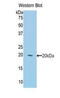 Keratin 2 antibody, LS-C304032, Lifespan Biosciences, Western Blot image 