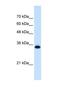 Solute Carrier Family 25 Member 38 antibody, NBP1-59559, Novus Biologicals, Western Blot image 