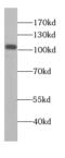 Alanyl-TRNA Synthetase antibody, FNab00276, FineTest, Western Blot image 