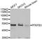 6-Phosphofructo-2-Kinase/Fructose-2,6-Biphosphatase 3 antibody, LS-B14221, Lifespan Biosciences, Western Blot image 