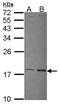 Ubiquitin Conjugating Enzyme E2 L3 antibody, PA5-30202, Invitrogen Antibodies, Western Blot image 