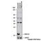 Transmembrane P24 Trafficking Protein 10 antibody, NB110-57586, Novus Biologicals, Western Blot image 