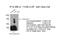 Folliculin antibody, 11236-2-AP, Proteintech Group, Immunoprecipitation image 