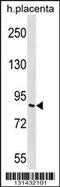 Adhesion G Protein-Coupled Receptor F2 antibody, 56-520, ProSci, Western Blot image 