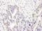 DNA Polymerase Delta 2, Accessory Subunit antibody, NBP2-32093, Novus Biologicals, Immunohistochemistry paraffin image 
