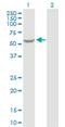 Glycerol Kinase 2 antibody, H00002712-D01P, Novus Biologicals, Western Blot image 