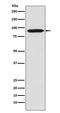 BCL6 Transcription Repressor antibody, M00142-1, Boster Biological Technology, Western Blot image 