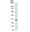 HLA class II histocompatibility antigen, DRB1-15 beta chain antibody, orb317075, Biorbyt, Western Blot image 