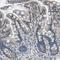 Catenin Delta 1 antibody, NBP1-85383, Novus Biologicals, Immunohistochemistry paraffin image 