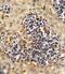 Receptor Tyrosine Kinase Like Orphan Receptor 2 antibody, 63-130, ProSci, Immunohistochemistry paraffin image 