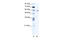 PDZ And LIM Domain 5 antibody, 28-042, ProSci, Western Blot image 