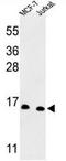 Small Nuclear Ribonucleoprotein D3 Polypeptide antibody, AP53966PU-N, Origene, Western Blot image 