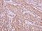 X-Linked Inhibitor Of Apoptosis antibody, GTX113130, GeneTex, Immunohistochemistry paraffin image 