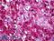 Serpin Family A Member 3 antibody, LS-B5371, Lifespan Biosciences, Immunohistochemistry paraffin image 