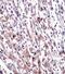 Egl-9 Family Hypoxia Inducible Factor 3 antibody, abx027889, Abbexa, Immunohistochemistry paraffin image 