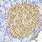 HtrA Serine Peptidase 2 antibody, LS-C334270, Lifespan Biosciences, Immunohistochemistry frozen image 