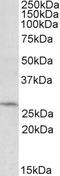 Defective In Cullin Neddylation 1 Domain Containing 1 antibody, orb20516, Biorbyt, Western Blot image 