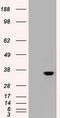 Caudal Type Homeobox 2 antibody, LS-C784139, Lifespan Biosciences, Western Blot image 