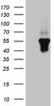 Serpin Family I Member 1 antibody, LS-C796275, Lifespan Biosciences, Western Blot image 