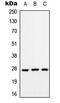 RAB33A, Member RAS Oncogene Family antibody, GTX55915, GeneTex, Western Blot image 