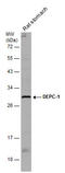 AlkB Homolog 3, Alpha-Ketoglutaratedependent Dioxygenase antibody, GTX131151, GeneTex, Western Blot image 