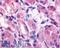 Histamine Receptor H2 antibody, LS-A1176, Lifespan Biosciences, Immunohistochemistry paraffin image 