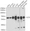 Chaperonin Containing TCP1 Subunit 5 antibody, GTX33537, GeneTex, Western Blot image 