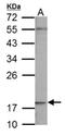 NADH dehydrogenase [ubiquinone] 1 beta subcomplex subunit 5, mitochondrial antibody, NBP1-31684, Novus Biologicals, Western Blot image 